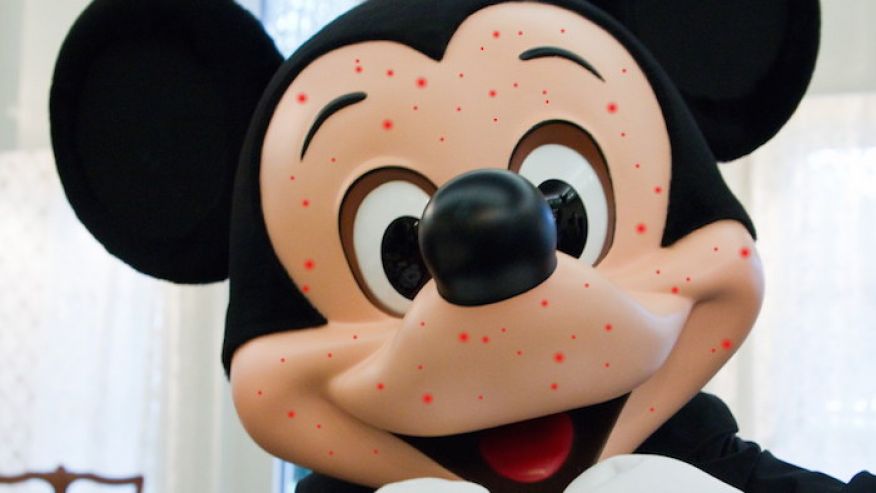 The Disneyland measles outbreak is a prime example on why I’m pro-vaccine